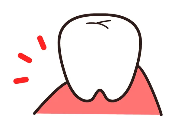 知覚過敏で歯がしみるイラスト